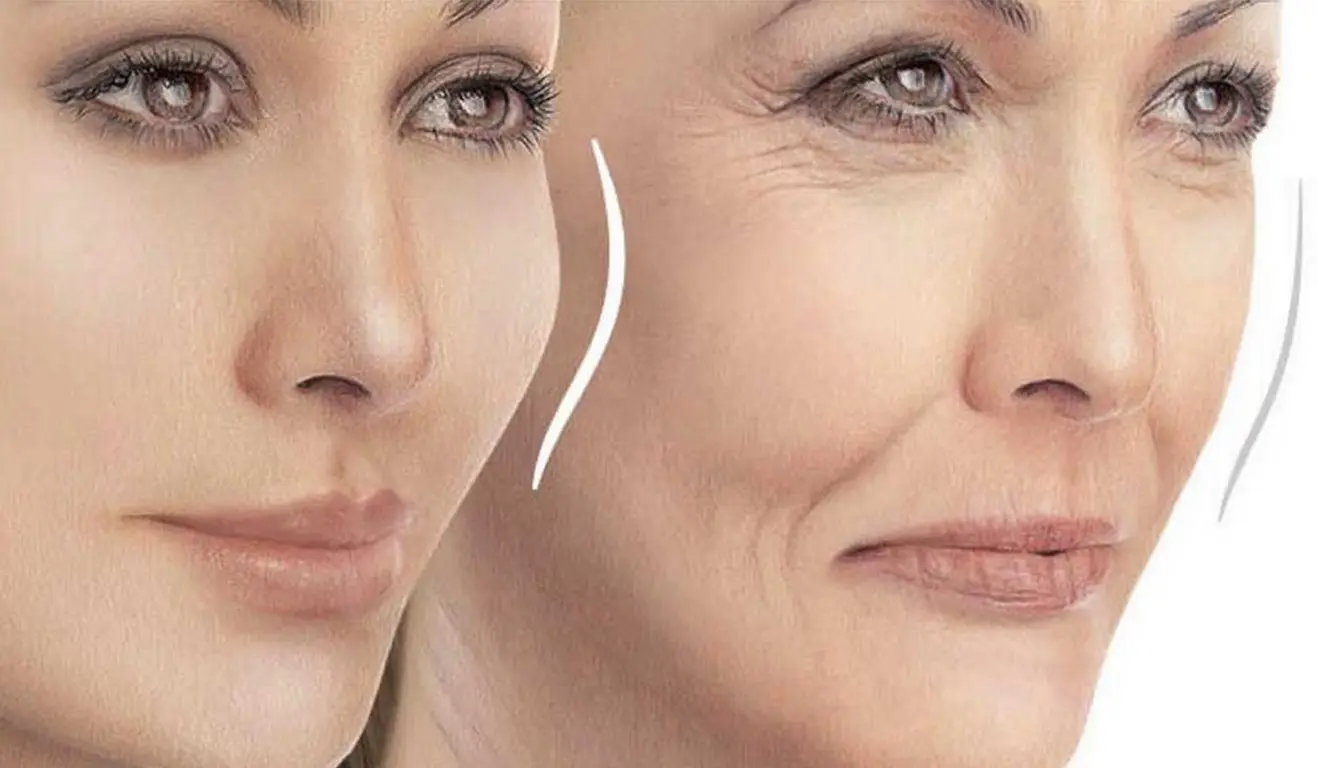 قبل و بعد تزریق چربی به صورت در تهران