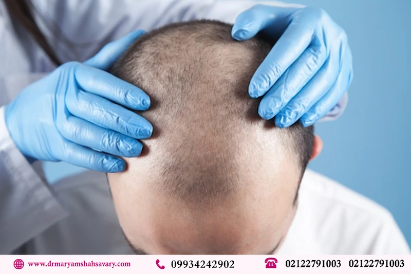 کاشت مو در کلینیک فرمانیه